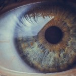 Kerato Conjunctivitis (Dry eye syndrome)