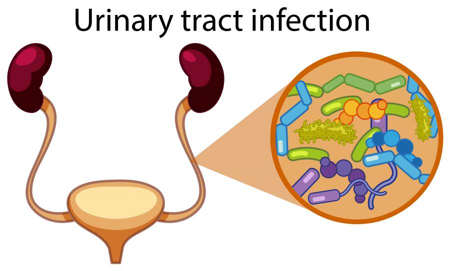 Home remedies for Urinary Tract Infection