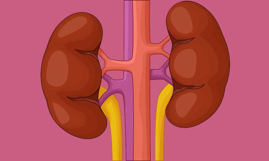 Most Effective Home Remedies for Kidney Stones