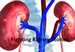 Fighting Kidney Stones