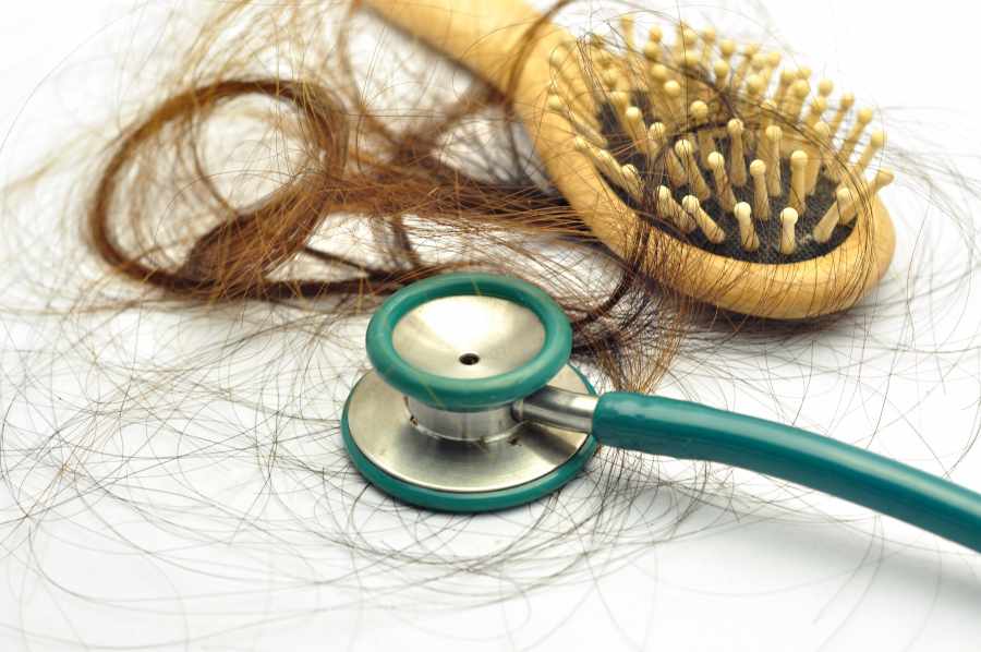 Reasons for Hair Fall and how to Prevent it Naturally