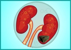 Kidney Disease in India
