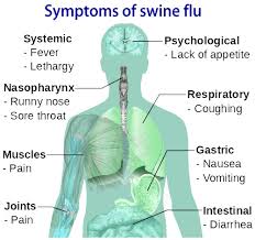 Swine Flu-Symptoms,Diagnosis and Cure