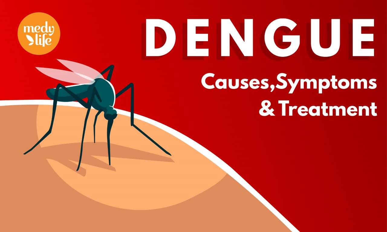 All you Wanted to know about Dengue Symptoms ,Its Causes & Treatment