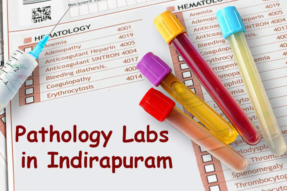 List of Best Pathology Labs in Indirapuram, Ghaziabad