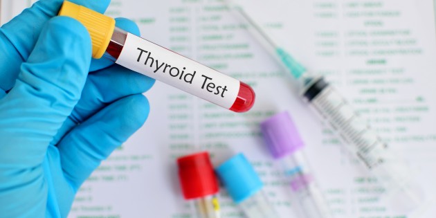 Types of Thyroid Disorders