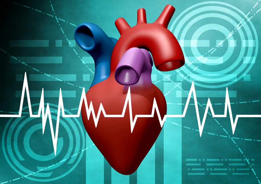 How To Take Care Of Cardiovascular Patients?