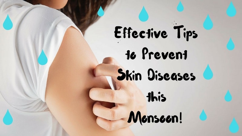 Prevent Skin Diseases