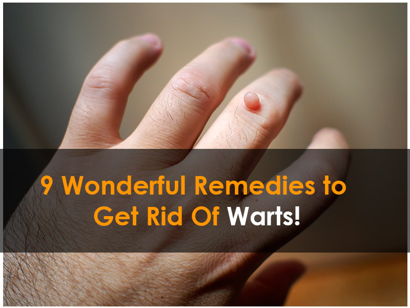 9 Wonderful Remedies to Get Rid Of Warts!
