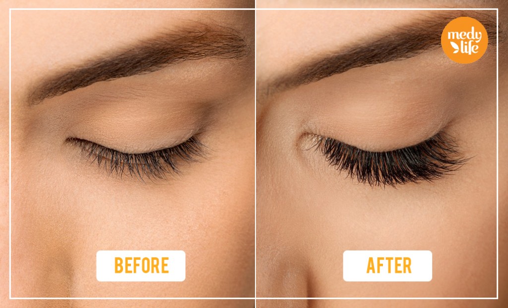 How to grow eyelashes fast