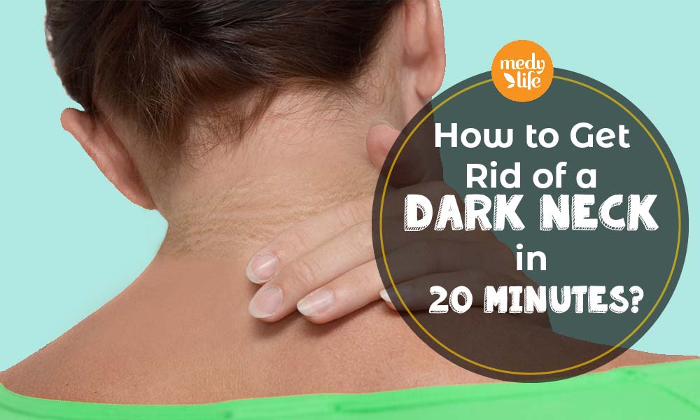 How to Get Rid of a Dark Neck in 20 Minutes