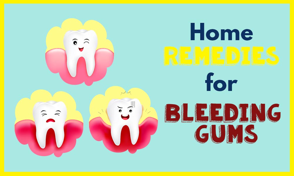 Home Remedies for Bleeding Gums