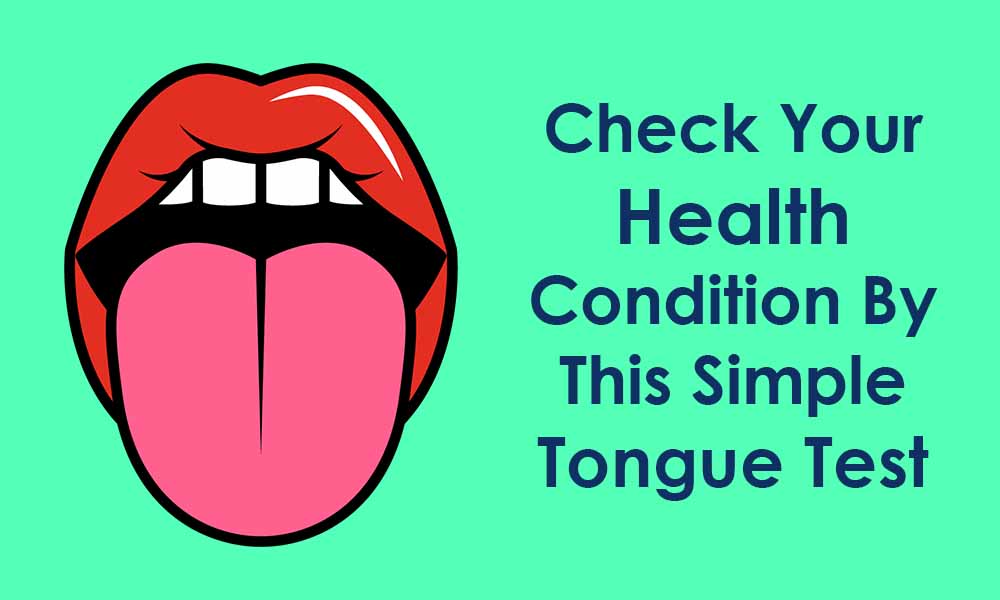 Check your Health from a Simple Tongue Test