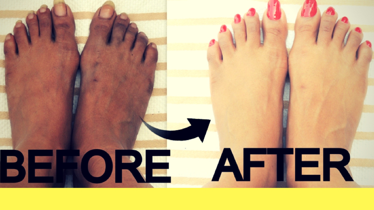 How to Whiten Feet in 20 Minutes? - Medy Life