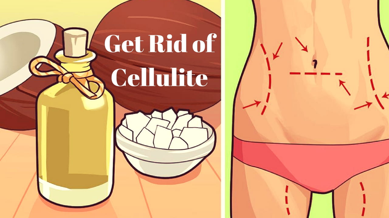 Cellulite: Get to Know About the Orange Peel Syndrome