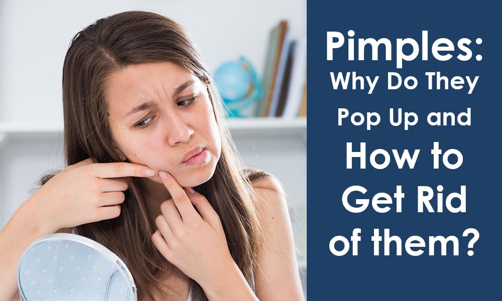 Tips to Get Rid of Pimples Overnight Medy Life