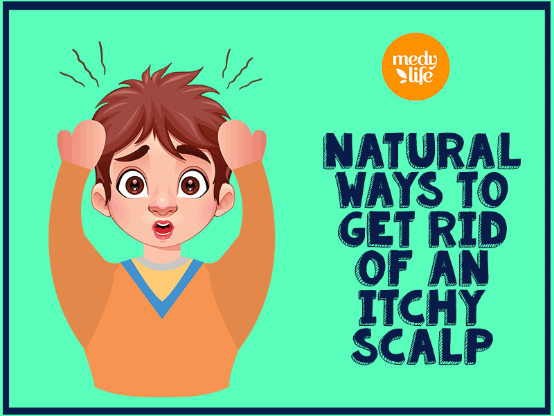 Natural-Ways-to-Get-Rid-of-an-Itchy-Scalp