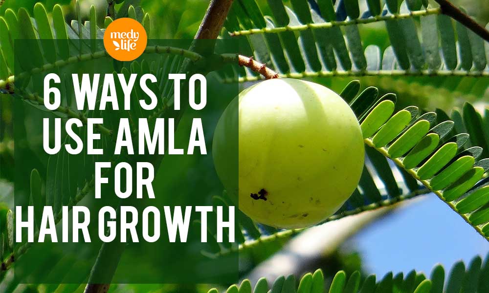6 Ways to Use Amla for Hair Growth - Medy Life