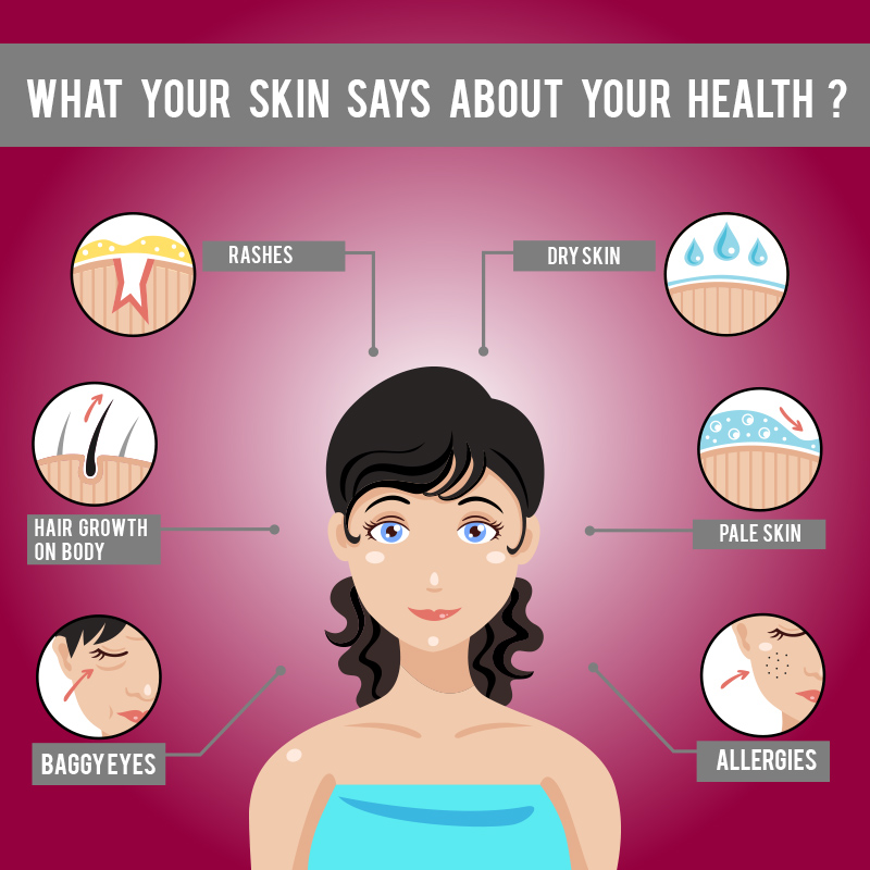 What your skin says about your health
