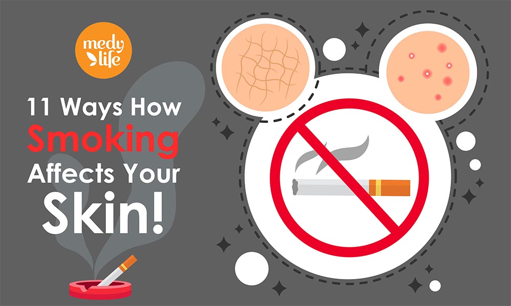 11 Ways How Smoking Affects Your Skin !